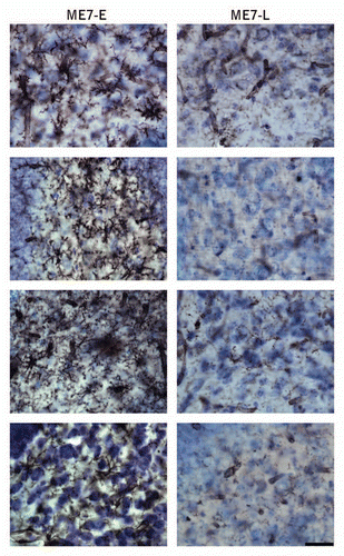Figure 3 Photomicrographs of the polymorphic layer of dentate gyrus of ME7 subjects at 12 w.p.i. after Lycopersicum esculentum histochemistry (n = 9) to illustrate microglial activation early in the disease. Right column show early microglial activation in 4 infected subjects (ME7-E) as compared with 4 subjects without early microglia activation (left column, ME7-L). Scale bar: 25 µm.