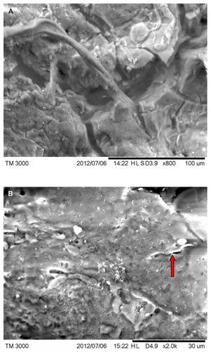 Figure 5 (A) Scanning electron microscopy (SEM), demonstrating typical appearance of filament projecting from skin surface, patient 2. Scale bar is shown at bottom of SEM. (B) SEM demonstrating the typical helical-shape outline of a spirochete under the skin surface, one-third down from top of right side (arrow). Scale bar is shown at bottom of SEM. (C) SEM of same specimen also demonstrating bacterial forms consistent with morphological variations of Borrelia spp. Scale bar is shown at bottom of SEM. (D) SEM of bovine digital dermatitis filaments, demonstrating filamentous and scaling surfaces. Scale bar is shown at bottom of SEM.