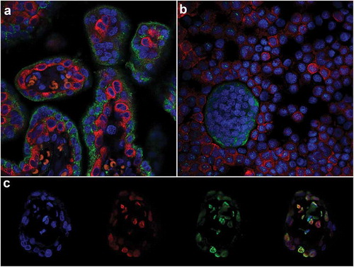 Figure 1. Immunofluorescent double-labelling in the placenta. (a) & (b). Paternally expressed gene 10 (PEG-10; cytotrophoblasts RED) and Pregnancy-specific beta-1-glycoprotein 1 (PSG-1; syncytiotrophoblasts GREEN) in an 8 weeks’ gestation placenta tissue section (a) and trophoblast cells isolated from 15 weeks’ gestation tissue (b). (c). Double-labelling of 5-mC and 5-hmC in a first-trimester placental villous; L-R: 4’,6-Diamidino-2’-phenylindole (DAPI; Blue, Nuclei), 5-hydroxymethylcytosine (5-hmC; Red), 5-methylcytosine (5-mC; Green) and all three images merged.