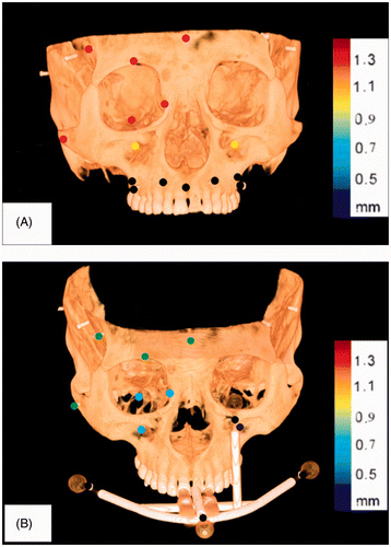 Figure 8. Target fiducial color-coded visualization value (colorwash dots) of the TRE for each registration fiducial (black dots) configuration. (A) Using registration fiducials on the maxillary alveolus. (B) Using registration fiducials on the device.