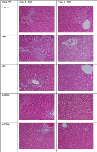 Figure 7. Effect of the extract of D. corderoyi on liver histology of STS-induced diabetic rats.