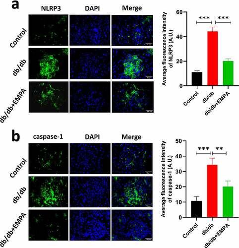 Figure 6. The results of immunofluorescence of in pancreas of mice treated with different methods as described above for six months. The expressions of NLRP3 (a) and caspase-1 (b) under three different treatment methods by immunofluorescence images and scores. ns P > 0.05; * P < 0.05; ** P < 0.01; *** P < 0.001. NLRP3: nucleotide-binding oligomerization domain-like receptor protein 3.