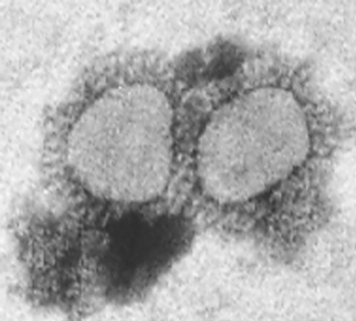 Figure 2.  Electron micrograph of the parrot coronavirus grown in macaw embryo liver cultures, following inoculation with samples of the liver, spleen and kidney.