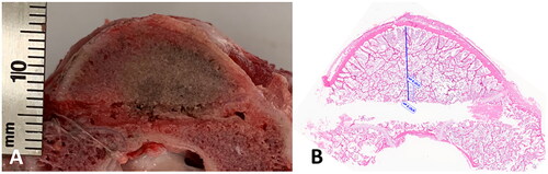 Figure 6. Transverse cut of vertebra, along the DMWA applicator pathway. Ablation conditions: 120 W, 5 min, room temperature initial temperature ex vivo ablation zone (A) Corresponding H&E stained section (B).