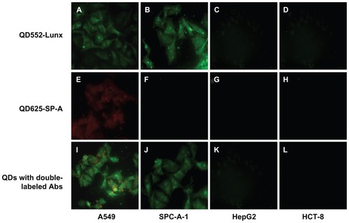 Figure 7 QDs with labeled Abs show Lunx and SP-A protein expression in different cancer cells. A549 cells (A) and SPC-A-1 cells (B) labeled with QD552-Lunx show green fluorescence. A549 cells (E) labeled with QD625-SP-A show red fluorescence and SPC-A-1 cells (F) labeled with QD625-SP-A do not show red fluorescence. A549 cells labeled with both QD552-Lunx and QD625-SP-A show both green and red fluorescence (I). SPC-A-1 cells labeled with both QD552-Lunx and QD625-SP-A show green fluorescence (J). Neither HepG2 nor HCT-8 cells emit any fluorescence signal (C, D, G, H, K and L).Note: The magnification was 100×.Abbreviations: Abs, antibodies; SP-A, surfactant protein-A; QDs, quantum dots.