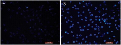 Figure 6. Representative fluorescence microscopy images of MC3T3-E1 on; (A) the plain scaffolds; (B) VEGF/BMP-2-loaded scaffolds.