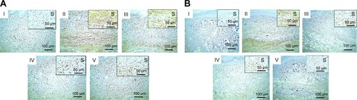 Figure 11 Immunostained rats paw skin against caspase-3.Notes: (A) Thin skin and (B) thick skin. (I) Normal group showing negative staining, (II) positive control exhibiting strong staining, (III) rats pretreated with 100 mg/kg Dcn showing moderate staining, (IV) and (V) rats pretreated with 1:10 Dcn:Glc SNEDDSs or 1:8 Dcn:TPGS SNEDDS, respectively, exhibiting mild staining. IHC counterstained with Mayer’s hematoxylin (100×); insert (S, 200×).Abbreviations: Dcn, diacerein; Glc, gelucire 44/14; TPGS, d-α-tocopheryl polyethylene glycol 1,000 succinate; SNEDDS, self-nanoemulsifying drug-delivery system; IHC, immunohistochemically.
