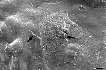 FIG. 8 SEM showing the inner aspect of Bowman's capsule of a cyst. The squamous epithelial cells have apical microvilli and a central cilium (arrow). Bar = 3 μm.