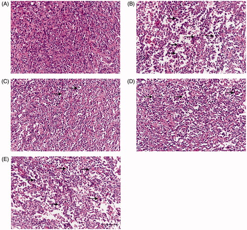 Figure 2. Histological examination of T24 xenografts (H&E staining). (A) Control group; (B) 20 mg/kg XAV-939 group; (C) 100 mg/kg QCSL group; (D) 200 mg/kg QCSL group; (E) 400 mg/kg QCSL group. Scale bars: 100 μm.
