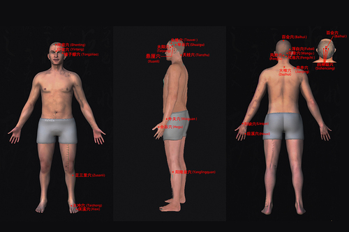 Figure 3 Acupoints schematic diagram.