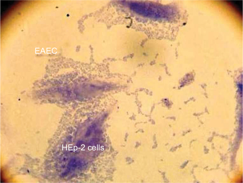 Figure 1 The AA pattern of EAEC to HEp-2 cells after 3 h of incubation.