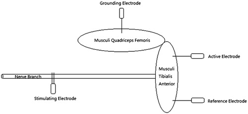 Figure 1. Diagram of CMAP measurement.