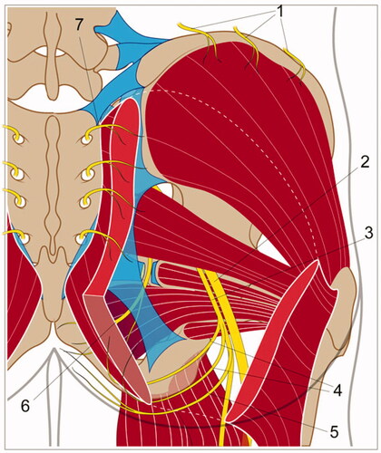 Figure 2. Nerves of the right-sided gluteal region, dorsal point of view. 1 = Superior cluneal nerves. 2 = Sciatic nerve. 3 = Posterior femoral cutaneous nerve. 4 = Inferior cluneal nerves. 5 = Perineal branches of posterior femoral cutaneous nerve. 6 = Pudendal nerve. 7 = Medial cluneal nerves. (© P.Bonnet).