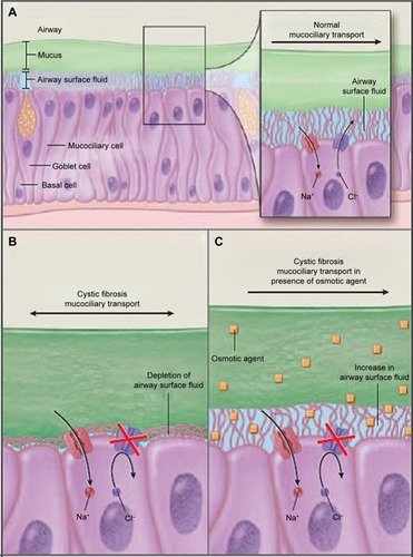 Figure 1 Normally functioning CFTR determines airway surface fluid depth by regulating Cl− (and bicarbonate) secretion and Na+ reabsorption (the latter indirectly through its influence on the epithelial Na channel [ENaC]).
