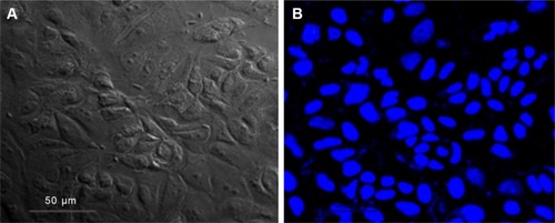 Figure 7 CLSM images of MCF-7 cells (A) under bright field and (B) nucleus stained with DAPI excited by a 405 nm laser.Abbreviation: CLSM, confocal laser scanning microscopy.