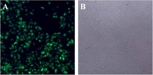 Figure 1 Infection of A549 cells with lentivirus carrying Bag-1 siRNA. A549 cells were grown and infected by Bag-1 or negative control siRNA. (A) Green fluorescence microscopy 48 hrs after infection. (B) Light field of the fluorescence microscopy 48 hrs after infection.
