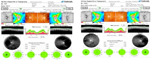 Figure 1 Disc report for healthy male subject showing good image quality for right (68%) and left eye (72%) at baseline and follow-up (70% right, 71% left) eye with an interim of 5 months.