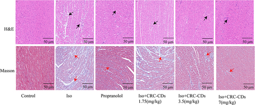 Figure 6 Histopathological changes in rat myocardium. ISO induced damage such as necrosis, edema, inflammatory cell infiltration (black arrow) and collagen fibril deposition (red arrow) in rat myocardium, whereas CRC-CDs improved the histopathological changes in rat myocardium.