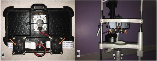 Figure 1 (A) Infrared camera module connected to smartphone. (B) Infrared camera module-smartphone complex mounted on slit lamp for steadier pupillography. Two mini-infrared cameras (arrows) and infrared light source (arrowhead) are shown.