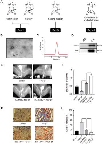 Figure 1 Exosomes from IL-1β-induced MSCs reduce urethral stricture in rabbits. (A) Schematic showing the design of animal experiments. (B) Transmission electron micrograph of vesicles isolated from MSCs (phosphotungstic acid negative staining). (C) Particle diameter distribution from nanoparticle tracking analysis of vesicles isolated from MSCs. (D) Western blot analysis of the exosomal markers TSG101 and CD63 in vehicles isolated from MSCs and vesicle‐free supernatant. (E) Typical retrograde urethrography images of rabbits treated with saline (control), TGF-β1 alone, TGF-β1 + Exo-MSCs, or TGF-β1 + Exo-MSCsIL−1β. (F) Diameters of urethras from rabbits treated as described for (E). (G) Representative images of Masson staining of collagen fibrosis in urethral tissue sections from rabbits treated as described for (E). (H) Quantification of fibrotic area of urethral tissue from rabbits treated as described for (E). Data in (F and G) are presented as the mean ± SD of n = 6 rabbits/group. Statistical analyses were performed with a t-test or t-test with Welch’s correction (*P < 0.05).