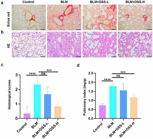 Figure 3. DSS alleviated BLM-induced PF in mice. (a-b) Sections of lung tissue were stained with HE staining and sirius red staining. Scale bar: 100 μm. (c) Histological scores. (d) The pulmonary index was measured. One-way ANOVA, ***p < 0.001, ****p < 0.0001, ns: non-significant