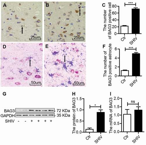 Figure 1. BAG3 is increased in astrocytes in the frontal cortex of SHIV-infected macaques
