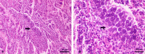 Figure 4.  Jejunum cross-section obtained from a 23-day-old broiler chicken, challenged with C. perfringens and E. maxima. Aggregation of schizonts as well as infiltration of heterophilic granulocytes and lymphocytes was observed (haematoxylin and eosin).