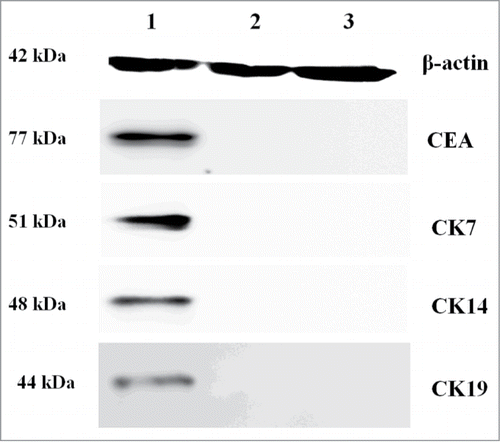 Figure 3. The expression of CEA, CK7, CK14 and CK19 proteins is modulated by NF-κB and Lef-1 in fibroblast cells. Equal amounts of cell lysates (containing 50 mg protein) were probed by specific antibodies as described in Materials and Methods Section. β-actin was used as a loading control. The pictures show CEA, CK7, CK14 and CK19 protein. The figure is representative of three separate experiments. The expression profiles of the specific markers and β-actin proteins in the Experimental group (Lane 1), empty vector control group (Lane 2) and negative control group (Lane 3) are shown. A significant difference between transfection with pcDNA3.1(+)-NF-κB and pcDNA3.1(+)-Lef-1 and transfection with vector alone or control is shown.