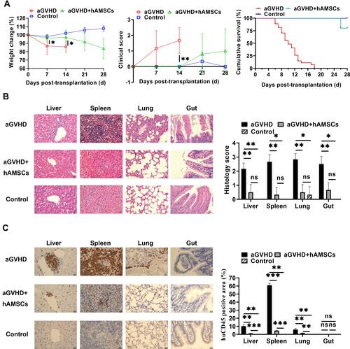 Figure 4 The capacity of hAMSCs inhibited the development of -aGVHD in vitro. (A) Measurement of weight change (aGVHD vs aGVHD+hAMSCs day 7 P=0.043, day 14 P=0.037), clinical score (aGVHD vs aGVHD+hAMSCs day 14 P=0.002), and survival in the different groups (aGVHD vs aGVHD+hAMSCs P<0.001). *p < 0.05 and **p < 0.01. (B) Representative histology of target organs, including the liver, spleen, lung, and gut. Compared with the hAMSCs treatment group, inflammatory cell infiltration and tissue damage in the aGVHD group were more severe. 400×. *p < 0.05 and **p < 0.01. (C) Representative immunohistochemistry of target organs, including the liver, spleen, lung, and gut. Infiltration and tissue damage in the aGVHD group were more severe than that of hAMSCs treatment group and Control group. 400×. **p < 0.01 and ***p < 0.001.