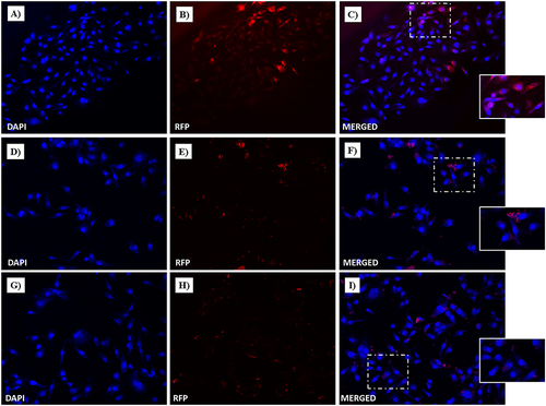 Figure 16 Fluorescent microphotographs showing the cellular location of Dox into human HaCaT cells following to free-Dox (A–C), NF-Dox (D–F) and P1+P2+P3+Dox (G–I) application. HaCaT were incubated with free- Dox (7.5 μM), NF-Dox and P1+P2+P3+Dox (50 µM, i.e., 7.5 µM of Dox) for 1 h. DAPI is used as a nuclear stain (shown in blue). The intrinsically fluorescence of Dox (RFP channel) is shown in red. Merged images derived from the overlapping of the two fluorescent emissions. The images shown are representative of 3 independent experiments.