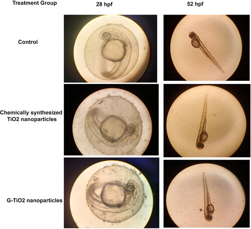 Figure 5. The microscopic images of zebrafish embryos in control, and post-treatment with 50 μg/ml of chemically synthesized TiO2 nanoparticles and G-TiO2 nanoparticles.