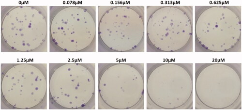 Figure 24. Folate receptor targeted celastrol AuNP (FCA) treatment group.