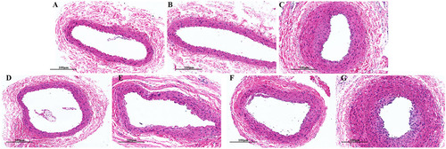 Figure 8. Pathological changes in the femoral arterial wall of all group, as observed using optical microscopy (H&E staining, ×200). (A) Control group, (B) sham group, (C) TAO model group, (D) aspirin group, (E) SMYAD-H group, (F) SMYAD-M group and (G) SMYAD-L group. Scale bar = 100 µm.