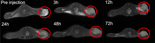 Figure 7 In vivo T2 MRI of 4T1 tumor-bearing mice at different time intervals (0, 3, 12, 24, 48 and 72 h) after injection with Fe3O4/DOX@CNSs (4 mg Fe/kg).