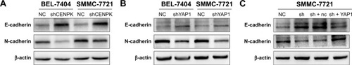 Figure 8 The YAP1 signaling pathway modulates the effects of CENPK on HCC EMT progress.Notes: (A) Expression of E-cadherin and N-cadherin in BEL-7404 and SMMC-7721 cells was determined by Western blotting after transfection with shCENPK lentivirus or shNC. (B) Expression of E-cadherin and N-cadherin in BEL-7404 and SMMC-7721 cells was detected by Western blotting after transfection with shYAP1 lentivirus or shNC. (C) Expression of E-cadherin and N-cadherin was examined by Western blotting in NC, shCENPK, shCENPK + nc, and shCENPK + YAP1 groups.Abbreviations: HCC, hepatocellular carcinoma; EMT, epithelial–mesenchymal transition; NC, negative control.