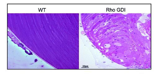 Figure 2 Abnormal lens phenotype in the neonatal Rho GDIα overexpressing transgenic mouse. Hematoxylin and eosin-stained sagittal sections of P1 RhoGDIα transgenic eyes reveal abnormal migration and morphology of the posterior lens fibers as compared with the symmetric organization of lens fibers and their migration toward the lens suture in the wild type mouse (reproduced with permission from Maddala et al.)Citation32.