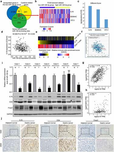 Figure 3. IL16 expression inversely correlated with miR-128-3p expression and was positively related to CD4+ Tregs infiltration in GC. (a) Venn diagram: The quartile distribution of miR-128-3p expression was used to divide GC tissues into low, medium and high expression groups. Three subsets, namely, upregulated genes in the low miR-128-3p group, cytokine-related genes, and genes with potential miR-128-3p binding sites, intersected. (b) Heatmap of IL16, SEMA4C, and STC1 expression in the low and high miR-128-3p groups. The color intensity corresponds to the enrichment Z-score: blue represents low expression, and red represents high expression. (c) Different scores for the expression of IL16, SEMA4C, and STC1 in the low miR-128-3p group. (d) Correlation analysis of miR-128-3p expression and IL-16 mRNA expression in 368 GC clinical samples in TCGA database. (e) Heatmap of the expression levels of IL16, enrichment score of CD4 + T cells and expression levels of miR-128-3p in 402 TCGA GC samples. Color intensity corresponds to the expression level Z-score: blue represents low expression, and red or yellow represents high expression. (f-h) Correlations between IL-16 and miR-128-3p (f), CD4 (g) or Foxp3 (h) in GC. (i) The expression of CD4, IL16 and Foxp3 and miR-128-3p mRNA levels was assessed by Western blotting and RT–qPCR. T: GC tissues; N: adjacent noncancerous gastric tissues. (j) The protein expression level of CD4, IL16 and Foxp3 was detected by immunohistochemistry.