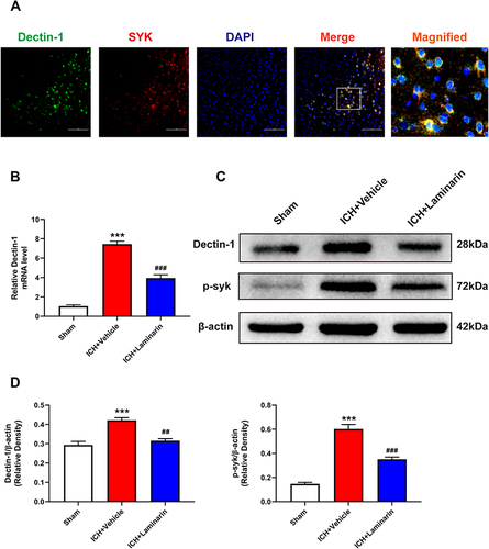 Figure 5 Laminarin inhibited the activation of the Dectin-1 signal after ICH. (A) Double immunofluorescence staining images of Dectin-1 co-located with SYK; n = 3. Scale bar = 100 μm. (B) Relative mRNA level of Dectin-1 in the perihematomal zone at 3 days following ICH; n = 6. (C and D) Protein bands and quantitative analysis of Dectin-1 and phosphorylation of SYK (p-syk); n = 4. Data are expressed as the mean ± SEM. ***p < 0.001 vs sham. ##p < 0.01, ###p < 0.001 vs ICH + vehicle.