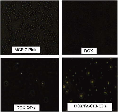 Figure 7. The fluorescence images of the treated MCF-7 cell lines with DOX, DOX-QDs and DOX/FA-CHI-QDs formulations.