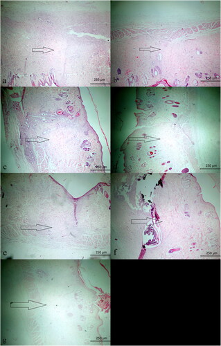 Figure 1. Prominent fibrosis is observed in wound healing in S-14 group (HE, ×40).