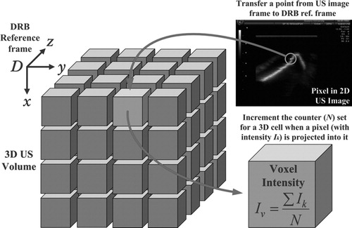 Figure 8. 3D US volume reconstruction process.