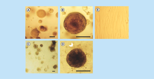 Figure 5.  MCF-12A cells co-cultured with Hs578Bst cells produce acini-like structures when embedded in Matrigel.(A & B) Representative optical microscopy images of MCF-12A cells embedded in Matrigel. (C & D) Optical microscopy images of MCF-12A cells co-cultured with Hs 578Bst cells showing acini-like structures. A second layer of cells seems to be surrounding the first layer in some of the acini (arrowhead), suggesting that myoepithelial cells formed bilayered acini with the luminal cells. (E) Optical microscopy image of Hs 578Bst cells embedded in Matrigel. Scalebars: 100 μm.