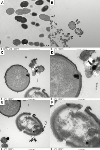 Figure 2 Representative TEM images of endocytosis of nanoparticles by E. faecalis.Notes: (A) E. faecalis (×30,000); (B–F) E. faecalis cocultured with Ag/Zn(1:1)-MCSNs. ×30,000 (B); ×100,000 (C and E); ×200,000 (D and F).Abbreviations: TEM, transmission electron microscopy; Ag/Zn-MCSNs, nanosilver- and nanozinc-incorporated mesoporous calcium-silicate nanoparticles.
