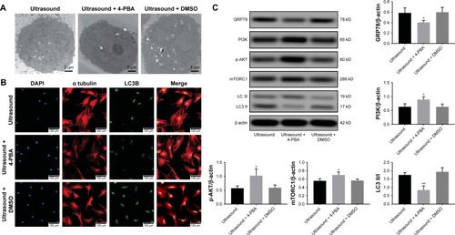 Figure 4 Low-frequency ultrasound induces autophagy via the ER-mediated PI3K/AKT/mTOR signaling pathway in PTX-resistant PC-3 cells.