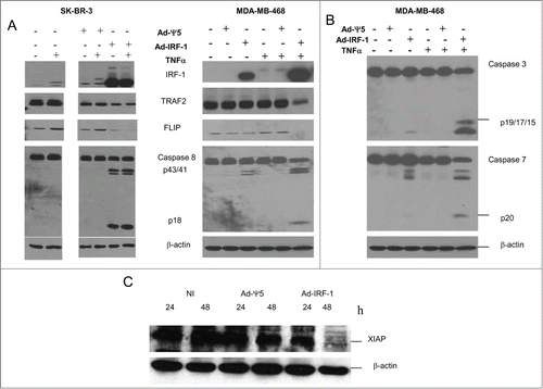 Figure 7. FLIP protein expression is suppressed by Ad-IRF-1 infection in human breast cancer cells. (A) SK-BR-3 and MDA-MB-468 human breast cancer cells were either uninfected or infected with Ad-Ψ5 or Ad-IRF-1 at a MOI of 50 and 25 respectively and cultured with or without 500 U/mL of TNF-α. After 24 h, cells were harvested and cellular lysates were loaded and utilized for immunoblotting as described in Materials and Methods. Multiple experiments were run on the same gel and at the same time, and the relevant results are presented. (B) MDA-MB-468 human breast cancer cells were either uninfected or infected with Ad-Ψ5 or Ad-IRF-1 at a MOI of 25 and cultured with or without 500 U/mL of TNF-α. After 24 h, cells were harvested and cellular lysates were loaded and utilized for immunoblotting as described in Materials and Methods. (C) XIAP expression is decreased in Ad-IRF-1 infected human breast cancer cells. MDA-MB-468 human breast cancer cells were either uninfected or infected with Ad-Ψ5 or Ad-IRF-1 and immunoblotting was conducted as described in Materials and Methods.