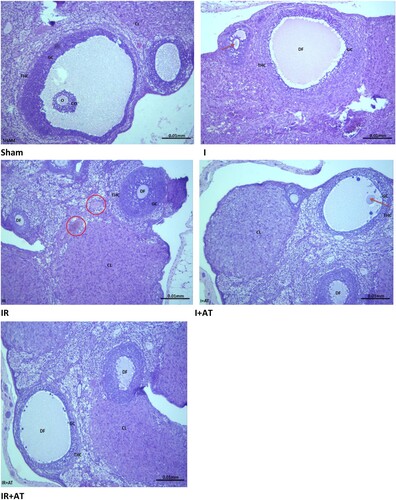 Figure 1. Photomicrographs of the ovarian tissues. Photomicrographs are representatives of 5 replicates per group. The sham-operated rats showed preserved ovarian histoarchitecture. There were oocytes (O) surrounded by cumulus oophorus (CO) that were lined by granulosa cells (GC) and theca cells (THC). The corpus luteum appeared normal. The rats in the ischaemia group (I) showed moderately distorted ovarian histoarchitecture. There were some degenerated follicles (DF) and some developing ooctes (red arrow). The granulosa cell (GC) and theca cells (THC) appeared normal. The rats in the ischaemia/reperfusion group (IR) showed grossly distorted ovarian histoarchitecture. There were degenerated follicles (DF) with distorted granulosa cell (GC) and theca cells (THC) that appeared infiltrated by inflammatory cells. The instertitium appeared congested (red circle). The animals in the ischaemia + atorvastatin group (I + AT) showed mildly distorted ovarian histoarchitecture. There were some degenerated follicles (DF) and some developing follicles (red arrow). The granulosa cell (GC) and theca cells (THC) appeared normal. Also, the corpus luteum (CL) appeared normal. The animals in the ischaemia/reperfusion + atorvastatin group (IR + AT) showed moderately distorted ovarian histoarchitecture. There were degenerated follicles (DF) with normal granulosa cell (GC) and theca cells (THC). The corpus luteum (CL) appeared normal.