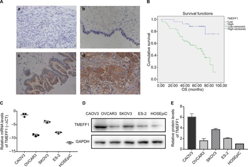 Figure 1 High expression of TMEFF1 correlates with worse clinical outcomes in ovarian cancer patients and the expression of TMEFF1 in ovarian cancer cell lines.Notes: (A) Expression of TMEFF1 in various types of ovarian tissues: (a) normal ovary; (b) benign epithelial ovarian tumor; (c) borderline epithelial ovarian tumor; and (d) epithelial ovarian cancer (×400). (B) Influence of TMEFF1 expression on the OS of ovarian cancer patients. (C–E) Protein and mRNA expressions of TMEFF1 in four ovarian and one normal ovarian cell lines.Abbreviation: OS, overall survival.