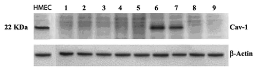 Figure 5. Cav-1 expression in human cancer cell lines. Cav-1 expression was determined using western analysis (Materials and Methods). A normal human mammary epithelial cell line (wild-type p53) was used as a positive control (HMEC). Lane 1, ZR-75–1 (breast tumor, ER+), wtp53; lane 2, BT-20 (breast carcinoma, ER+-); lane 3, T47D (breast carcinoma-ductal, ER+), mtp53; lane 4, MCF-7 (breast carcinoma-ductal, ER+), wtp53; lane 5, SKBr3 (breast adenocarcinoma, ER- / HER-2 2+), mtp53; lane 6, MDA-MB-157 (breast carcinoma, ER-), mtp53; lane 7, MDA-MB-231 (adenocarcinoma, ER-), mtp53; lane 8, BT474 (breast carcinoma, ER+), mtp53; lane 9, Caco-2 (colon adenocarcinoma, ER+), p53-null. The p53 status of each cell is as indicated.