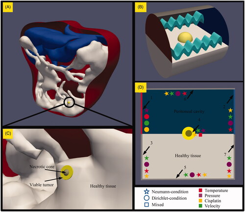 Figure 1. Geometry, methods and boundaries considered in this study. (A) A model representing the peritoneal cavity with a microscopic peritoneal nodule on the intestinal tract of the patient. (B) An enlarged version showing the three different types of tissue modeled in this study; healthy intestinal tissue, viable tumor tissue and a necrotic region at the center of the tumor. The tumor is embedded half way into the healthy tissue for all geometries. The size of the tumor varied from 1 to 4 mm. (C) The model during the simulation, where the yellow tumor embedded in the healthy white intestinal tissue is exposed to flow conditions relevant for HIPEC. The fluid, depicted by the waves, flows from the red side on the left to the blue side on the right. (D) The various boundary conditions encountered in the model which are explained in the boundary condition section.