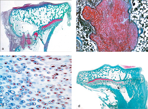 Figure 5. Histological sections of proximal tibiae 12 weeks after operation.(a) Elongated cartilage clusters were observed in the defect of the left tibia (Safranin-O).(b) Hypertrophied chondrocytes in the cartilage clusters were arranged haphazardly.The extracellular space was stained positively with Safranin-O, but the staining was less intense than in the intact lateral physis (× 40).(c) Hypertrophied chondrocytes were immunoreactive for S-100 protein (× 200).(d) Bony physeal bar formed in the right tibial defect (Safranin-O).